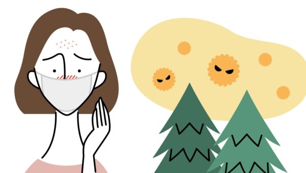 【速報】花粉は「鼻」より先に“肌”を襲う！〈皮膚科専門医が解説〉 1〜2月から“花粉ダメージ”が始まっていた！！！1〜2月から“花粉ダメージ”が始まっていた！！！ 専門医が警鐘「春を待っていたら、もう手遅れです」 女性400人調査で判明した“プレ花粉ショック”とはーーー？