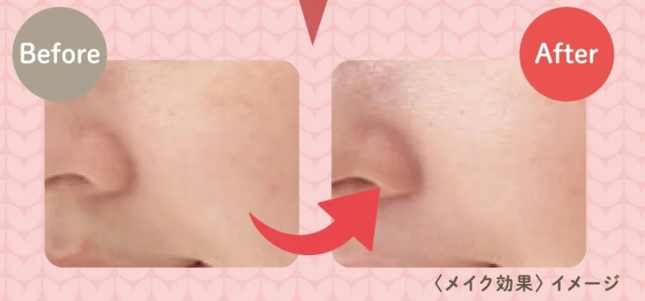 鼻と頬の領域における肌のビフォーアフター比較