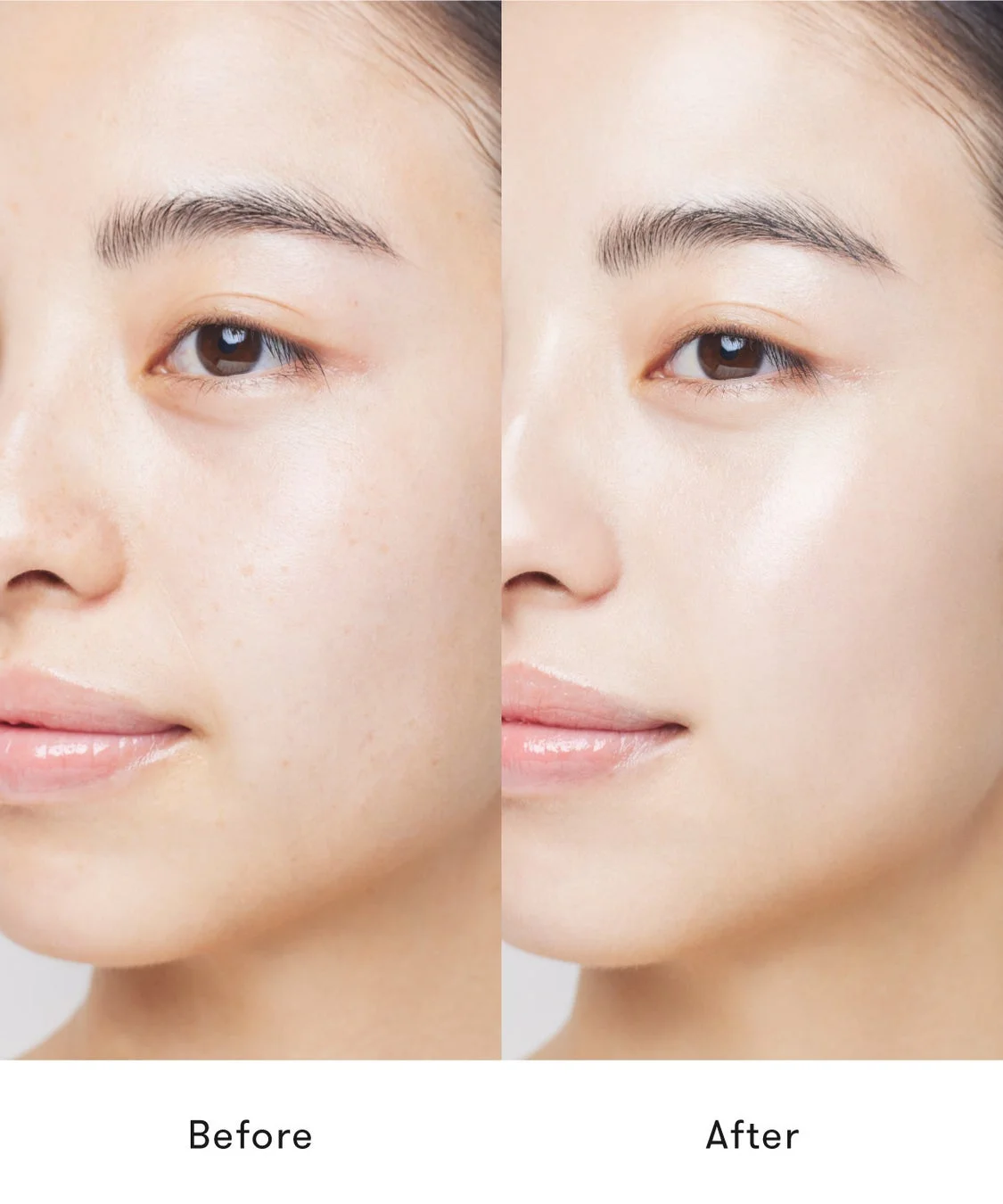 Before Afterの肌比較