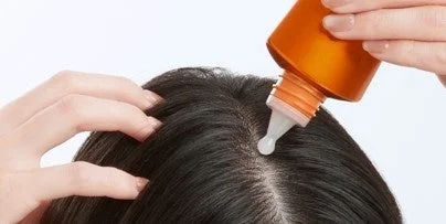 女性が髪を分け、オレンジ色のボトルに入った液体を直接頭皮に塗布している様子