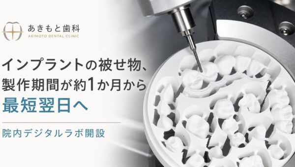 インプラントの被せ物、製作期間が約1か月から最短翌日へ横浜のあきもと歯科が院内デジタルラボを開設